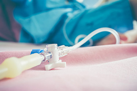 Exploring the Types of IV Catheters